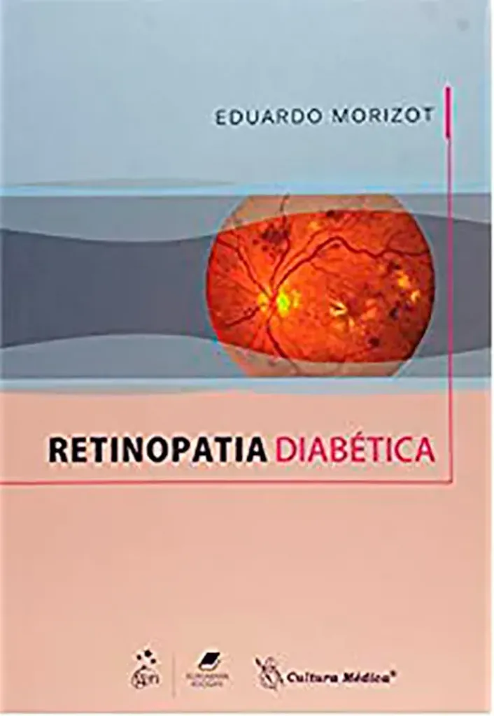 Imagem de Retinopatia Diabética