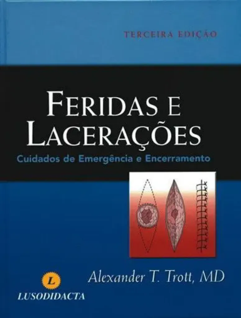 Imagem de Feridas e Lacerações